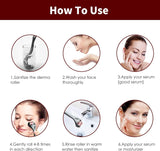 Micro Needling Derma Roller For Women and Men 0.5mm